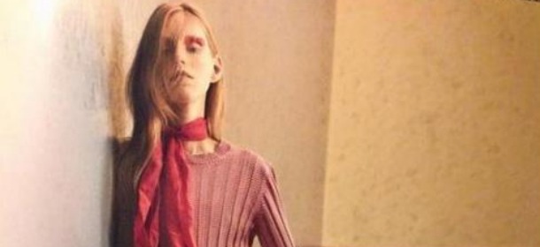 La modella anoressica fa insorgere il popolo della rete. Il direttore di Cover Magazine si scusa