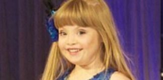 Kayla, la baby modella con la sindrome di Down in passerella per Gap