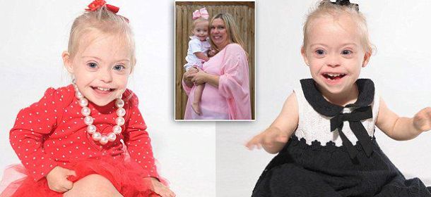 Connie-Rose, la bimba con la sindrome di Down diventata modella grazie al suo sorriso