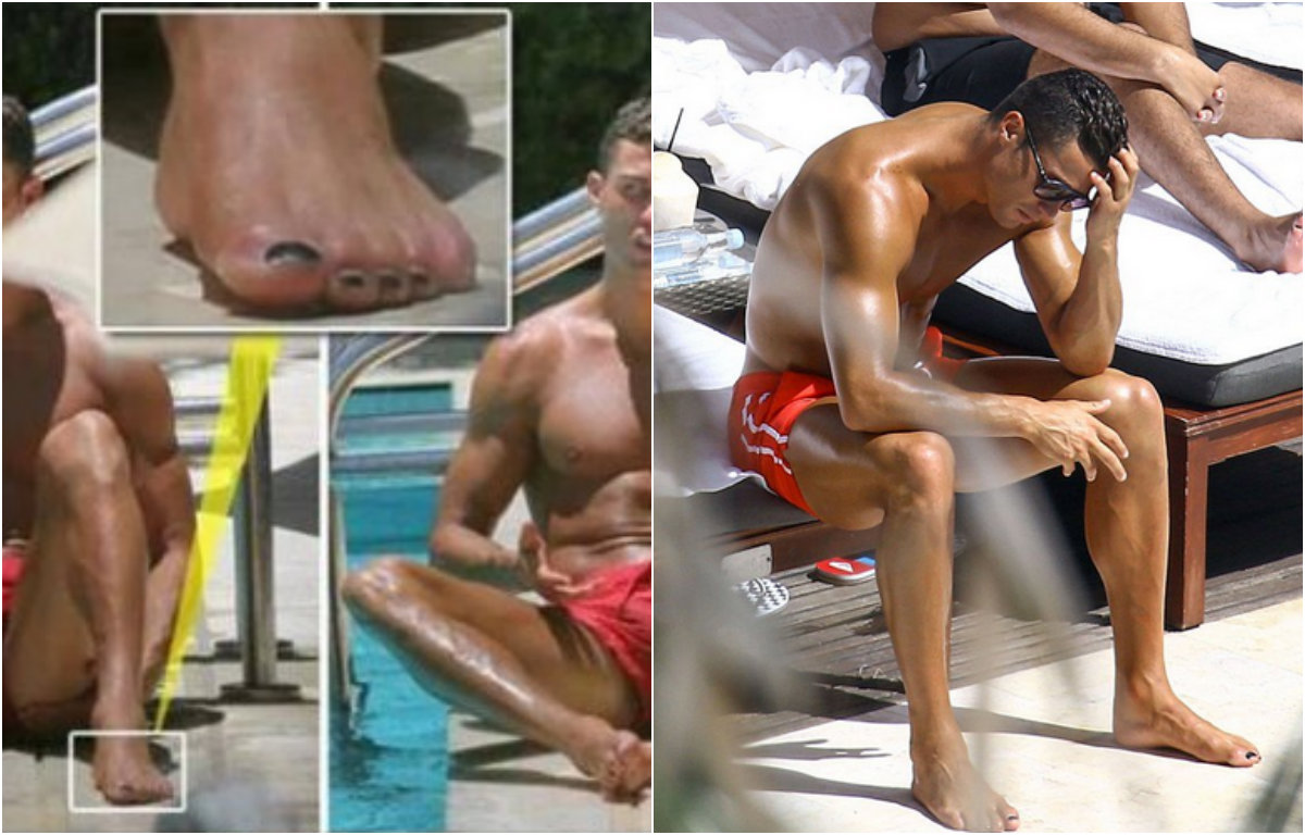 Cristiano Ronaldo: la bufera dello smalto ai piedi