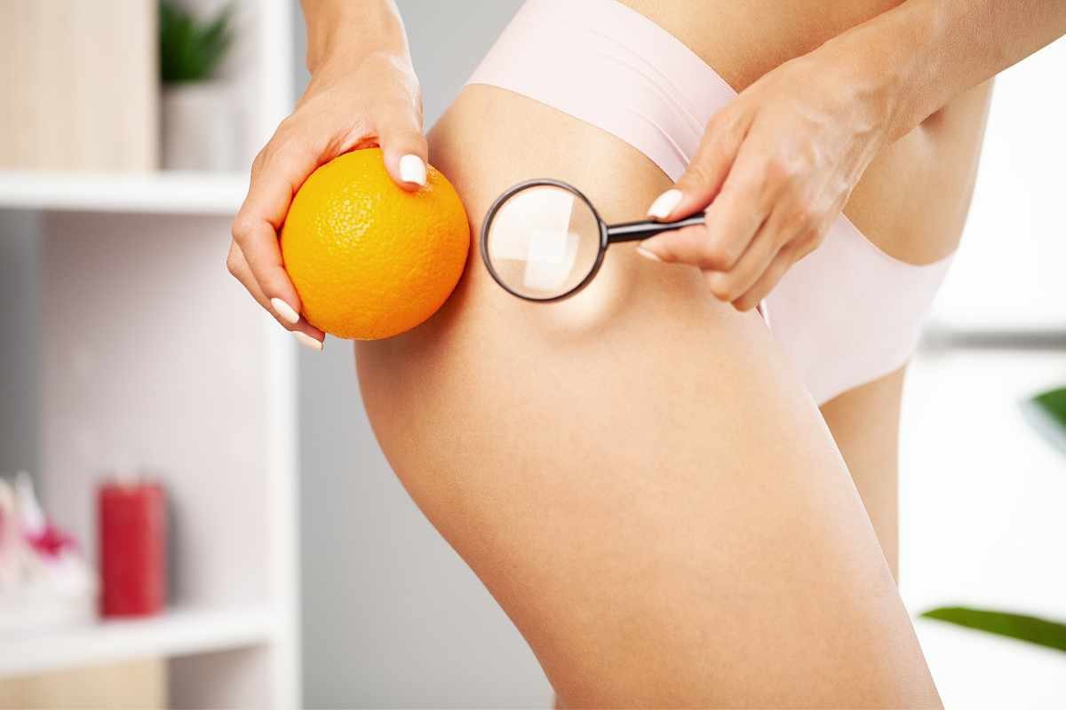 Contrastare la cellulite