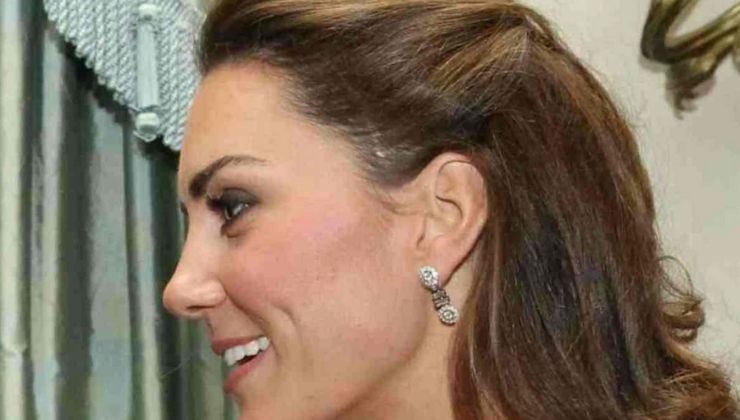 kate middleton spuntata cicatrice