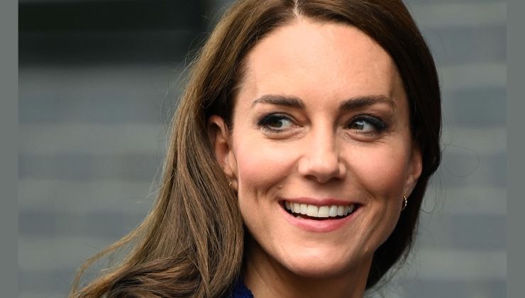 kate middleton motivo della cicatrice