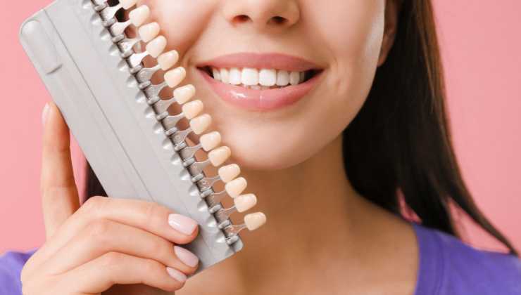 Indicazioni e controindicazioni della faccetta dentale di ceramica
