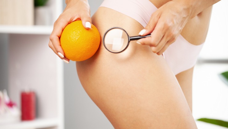 Cellulite: eliminala con questa dieta 